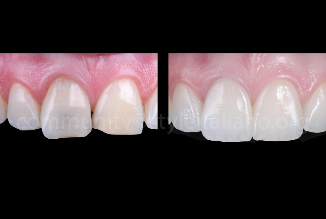 Advanced Techniques and Materials for Natural Aesthetic