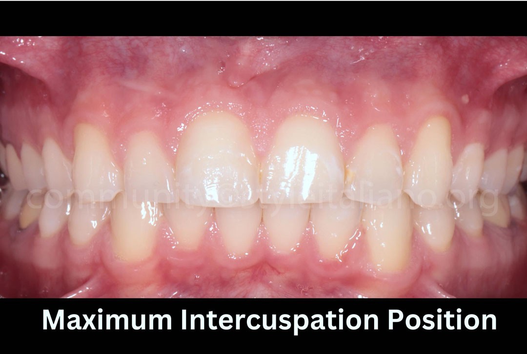 Styleitaliano_2024_56_24_HASBINI_06 styleitaliano style italiano Picture of the patient’s mouth white dental beauty restoring and preserving dental esthetics occlusal function