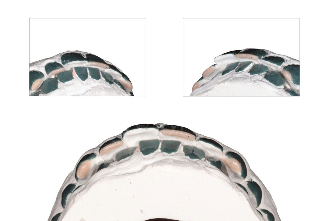 Styleitaliano_2024_56_24_HASBINI_08 styleitaliano style italiano Models created with wax-up white dental beauty restoring and preserving dental esthetics occlusal function