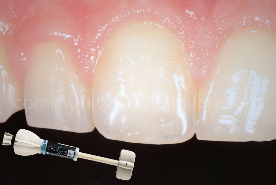 Styleitaliano_2024_56_24_HASBINI_09 styleitaliano style italiano Shade selection white dental beauty restoring and preserving dental esthetics occlusal function