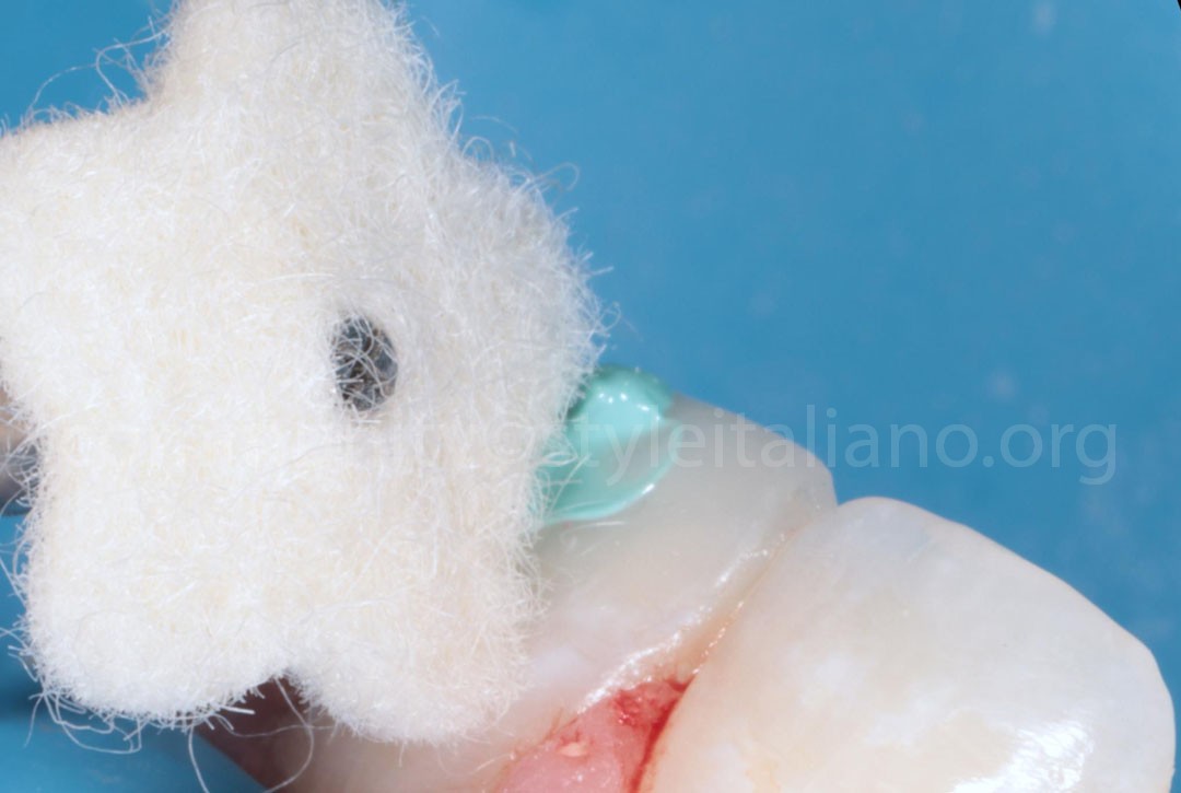 Styleitaliano_2024_56_24_HASBINI_21 styleitaliano style italiano Finishing and polishing white dental beauty restoring and preserving dental esthetics occlusal function