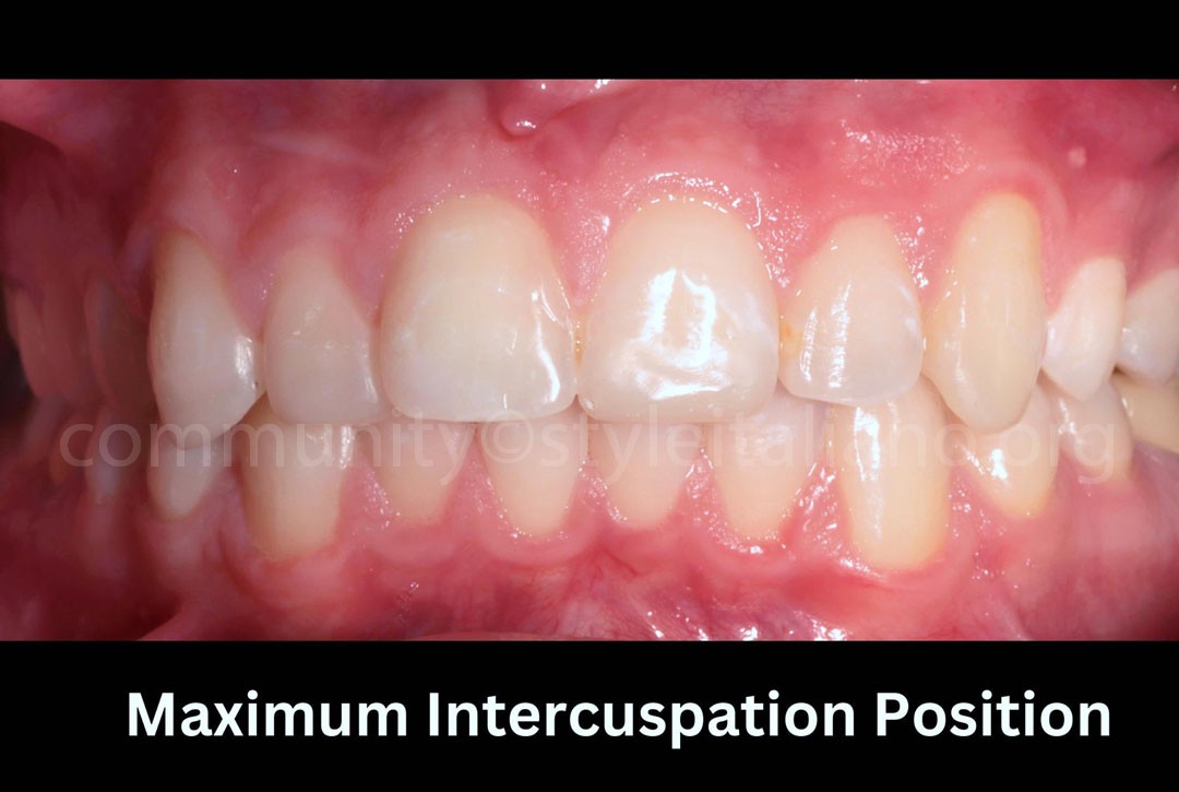 Styleitaliano_2024_56_24_HASBINI_24 styleitaliano style italiano Patient in a Maximum Intercuspation Position white dental beauty restoring and preserving dental esthetics occlusal function