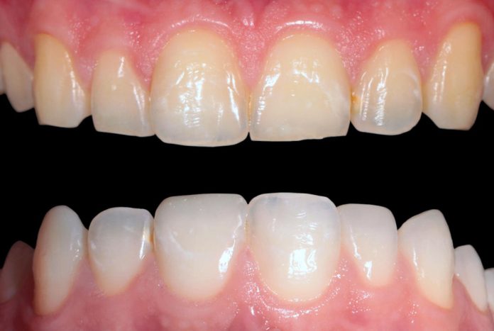 styleitaliano style italiano white dental beauty restoring and preserving dental esthetics occlusal function