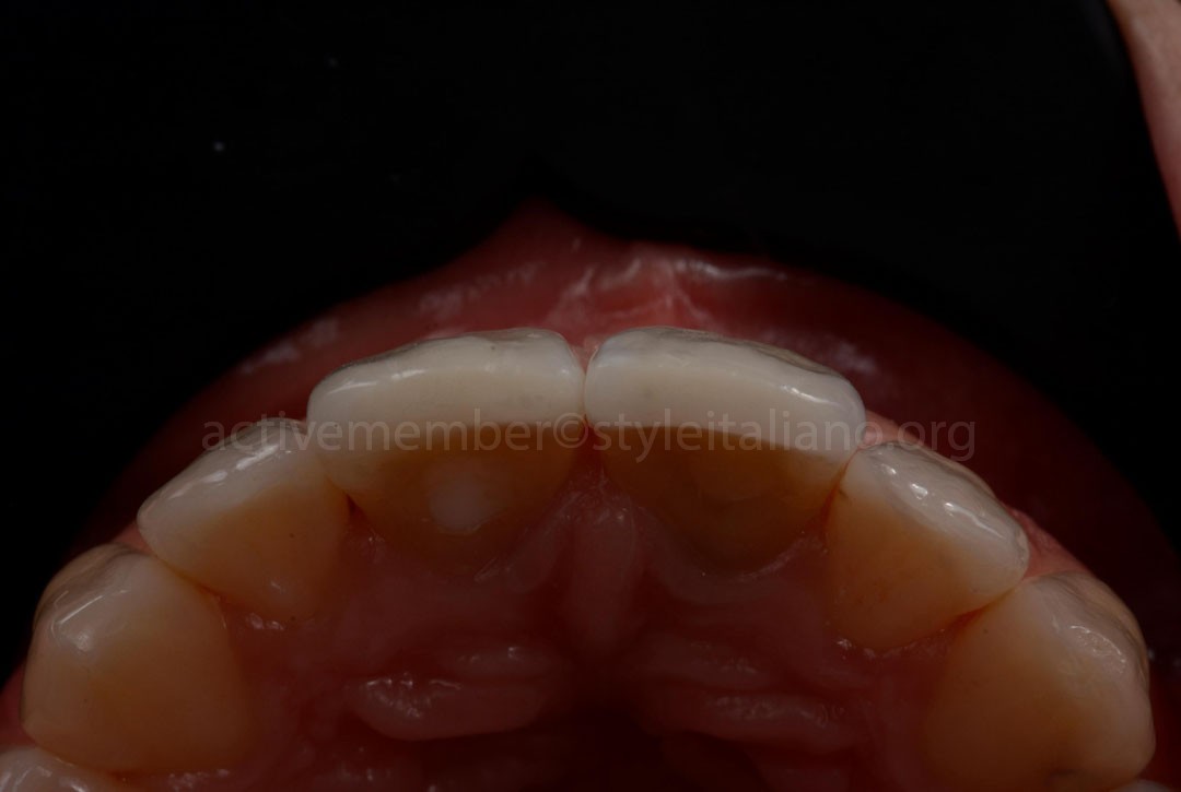 StyleItaliano_2026_43_26_DEVOTO_15 Final result occlusal view