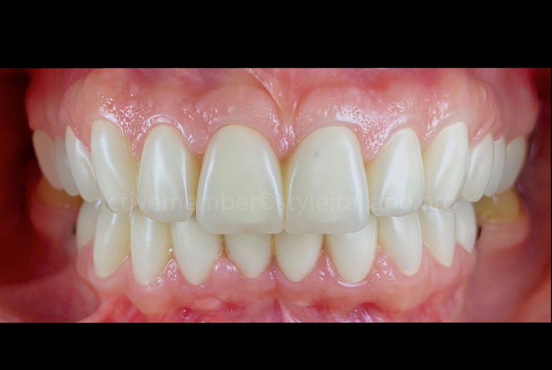 New provisionals